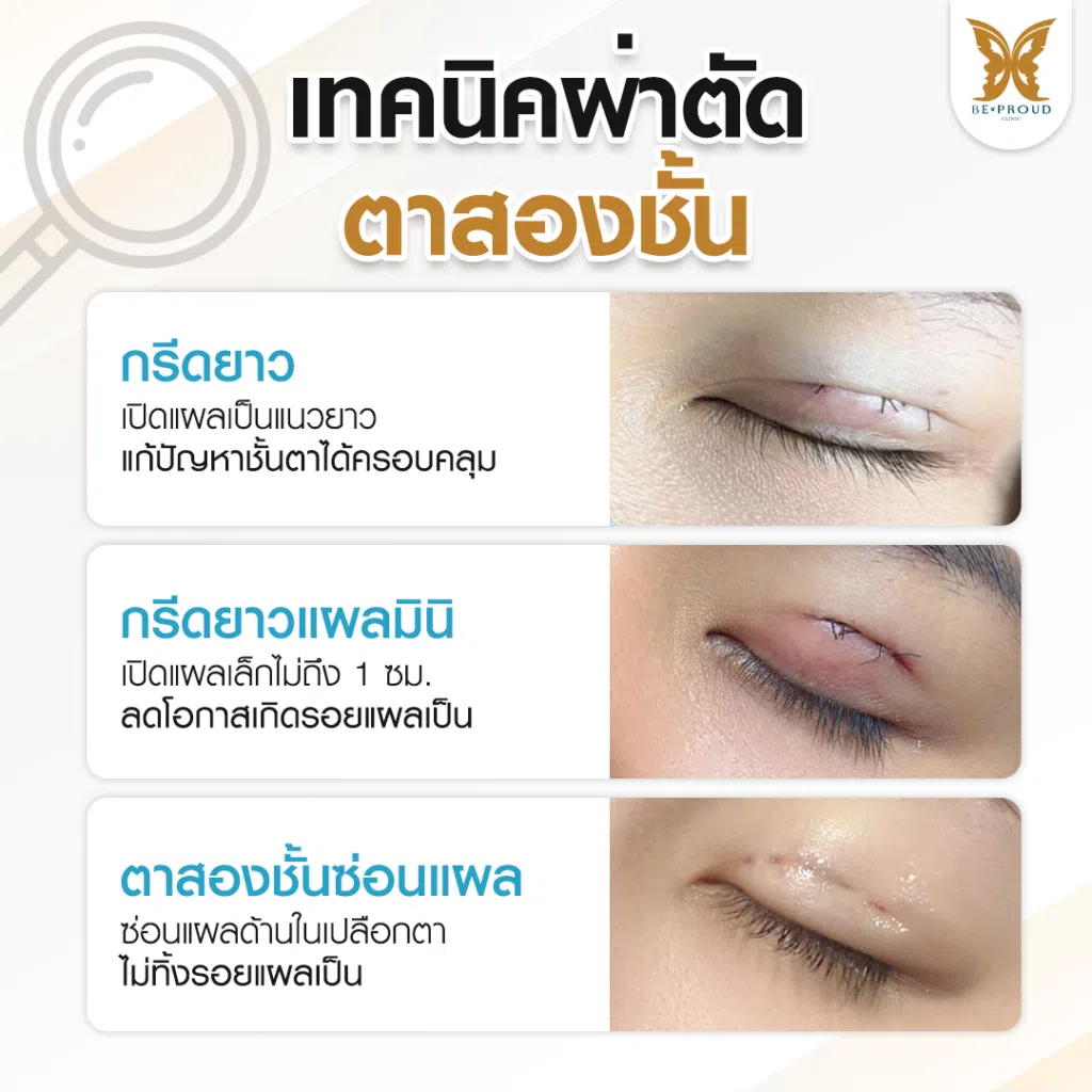 เทคนิคพิเศษตา หมอหลิง