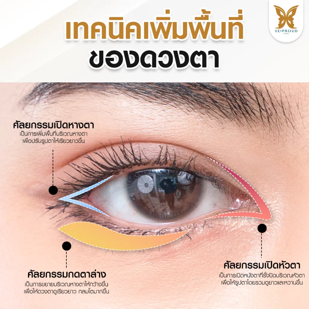 เทคนิคพิเศษตา หมอหลิง