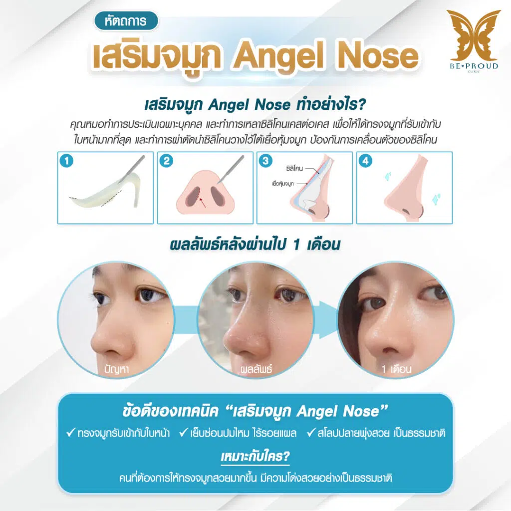 ฺเสริมจมูก Bproud Clinic