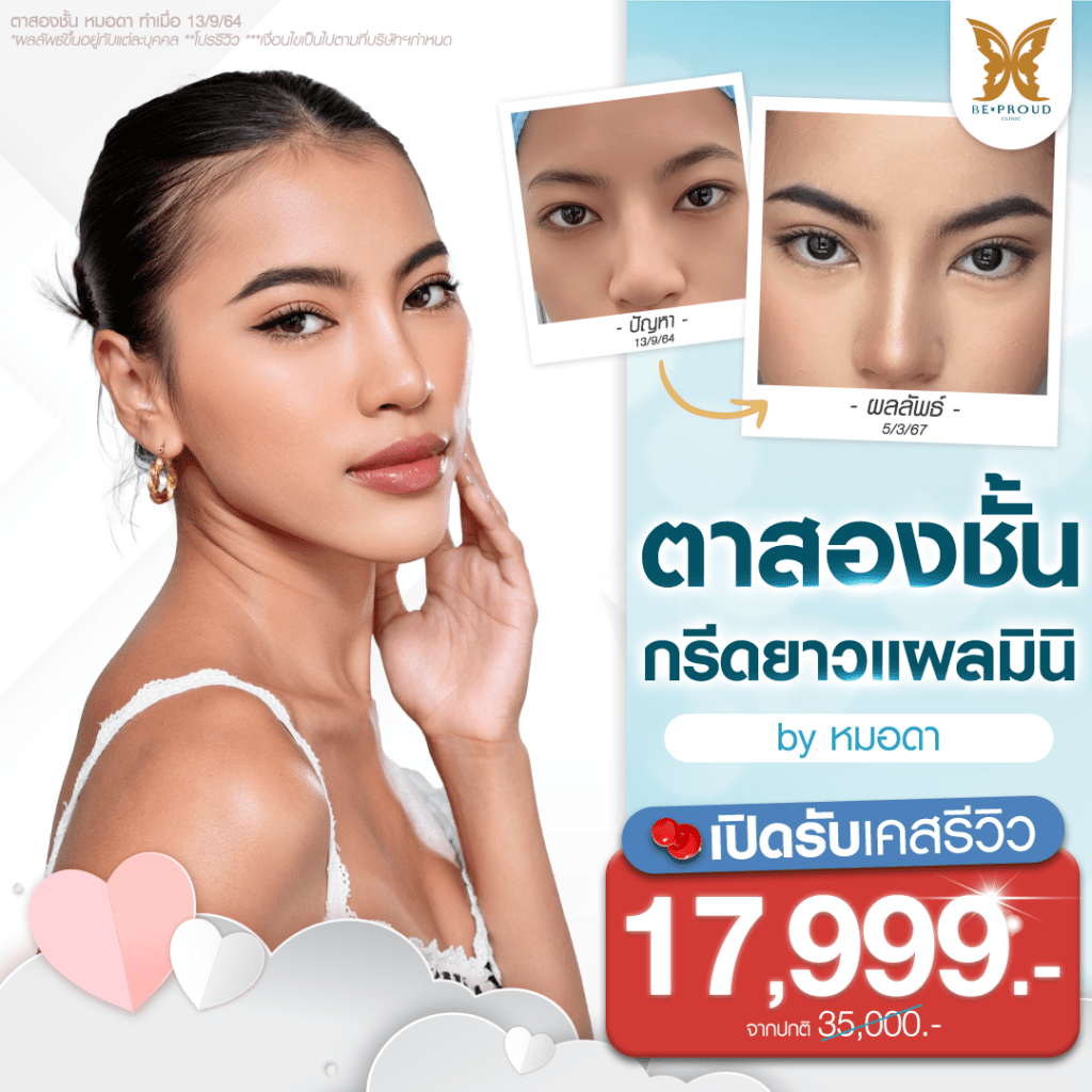 ปากกระจับ โปรโมชั่น - ตาสองชั้น