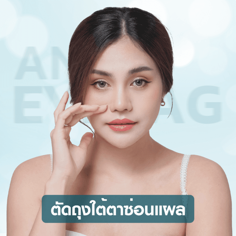 หัตถการตัดถุงใต้ตาซ่อนแผล