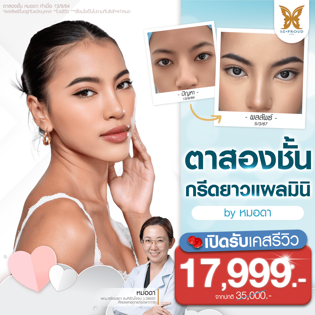 ตาสองชั้น เคสแก้ปัญหา หนังตาตก และเพิ่มความคมชัดของชั้นตา โดย หมอดา บีพราวด์