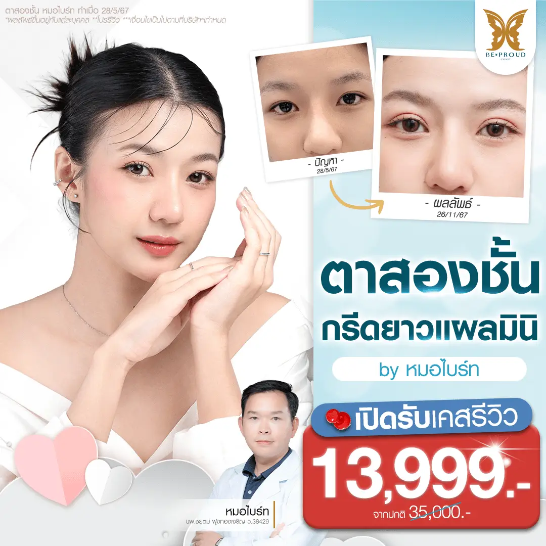 รีวิวตาสองชั้น รีวิวตาสองชั้นกรีดยาวแผลมินิ