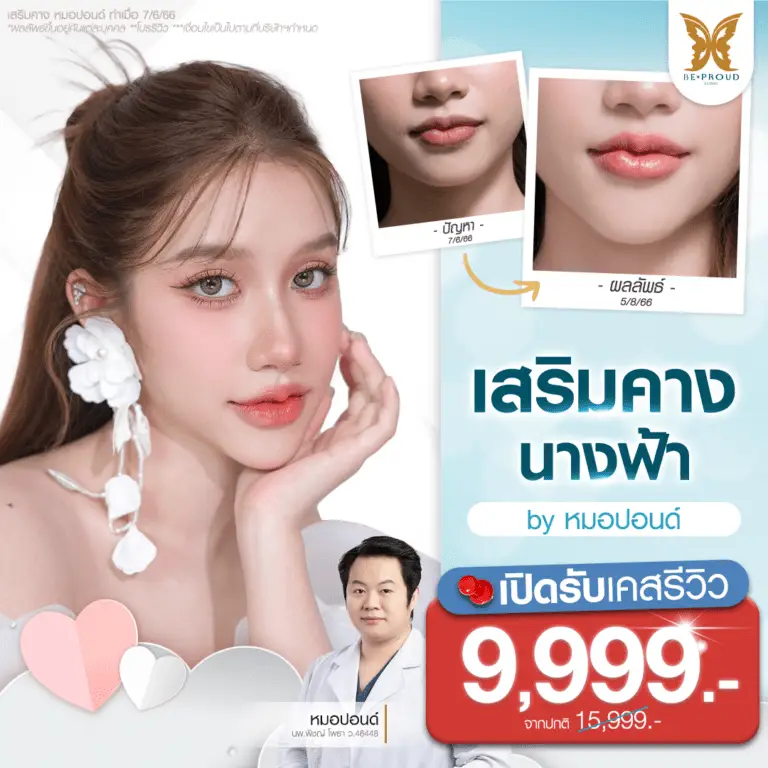 ผลลัพธ์การ เสริมจมูก ด้านข้าง สันจมูกโด่งคม หมอปอนด์บีพราวด์เป็นผู้ทำ