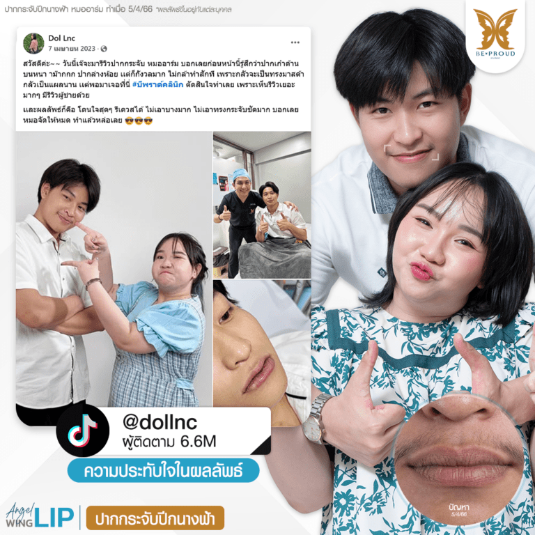 รีวิวความประทับใจศัลยกรรมปากกระจับปีกนางฟ้าของอินฟลูเอนเซอร์ คุณเก๋าแฟนเจ๊ตับฉ่ำโบ๊ะ @dollnc กับหมออาร์ม ที่บีพราวด์คลินิก
