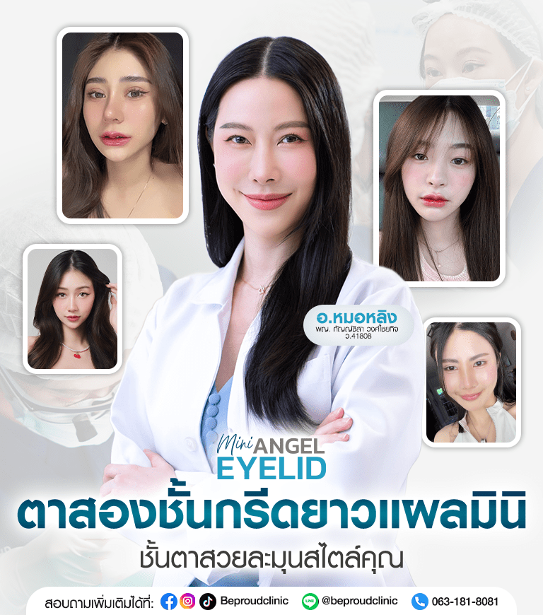 หัตถการตาสองชั้นกรีดยาวแผลมินิ บีพราวด์