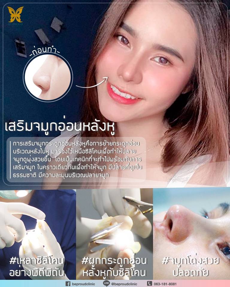 การเสริมจมูกกระดูกอ่อนหลังหู