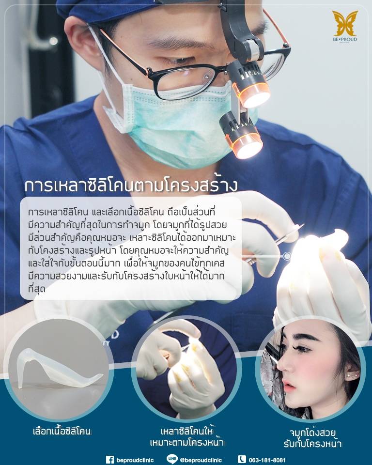 เหลาซิลิโคนตามแบบโครงสร้าง