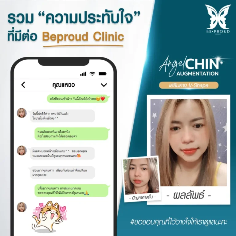 เสริมคาง บีพราวด์