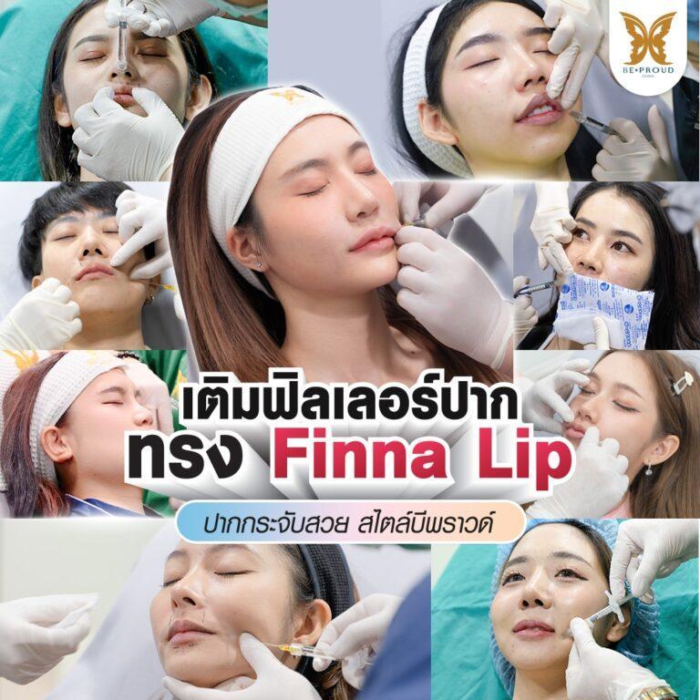 Filler Beproud Clinic
