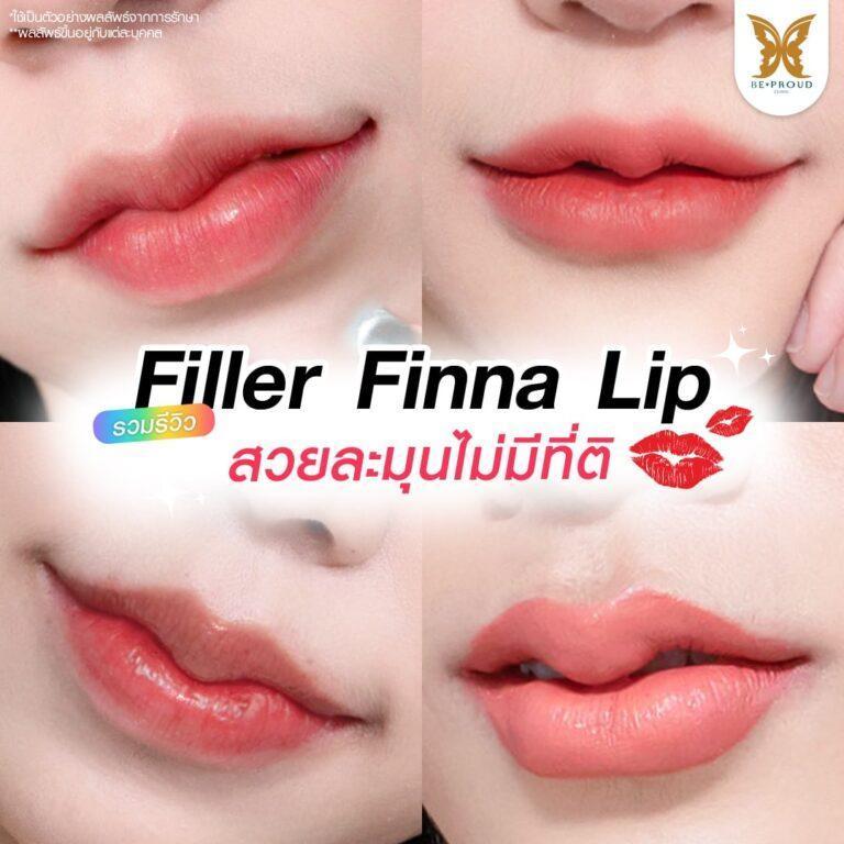 Filler Beproud Clinic
