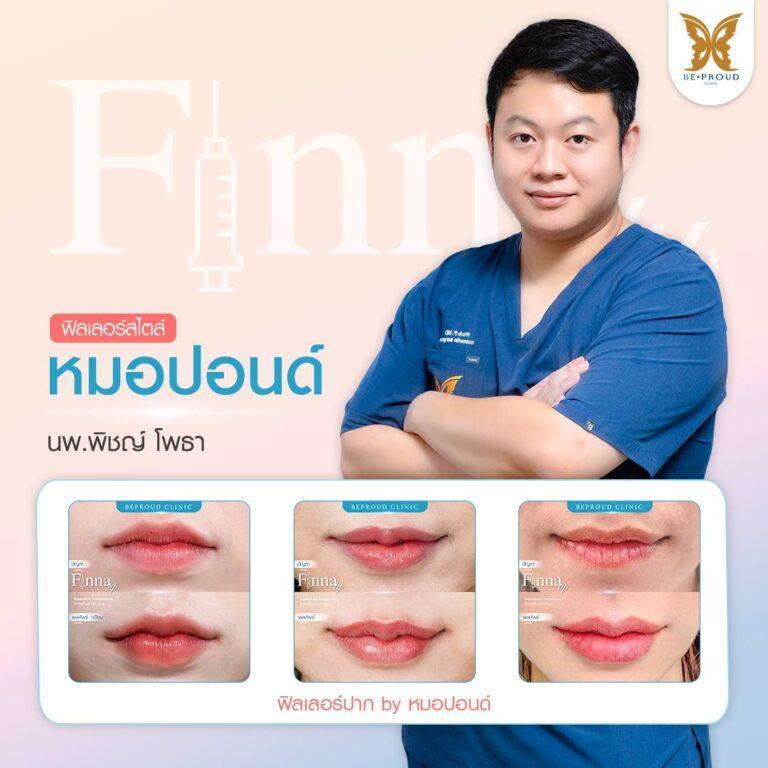 Filler Beproud Clinic