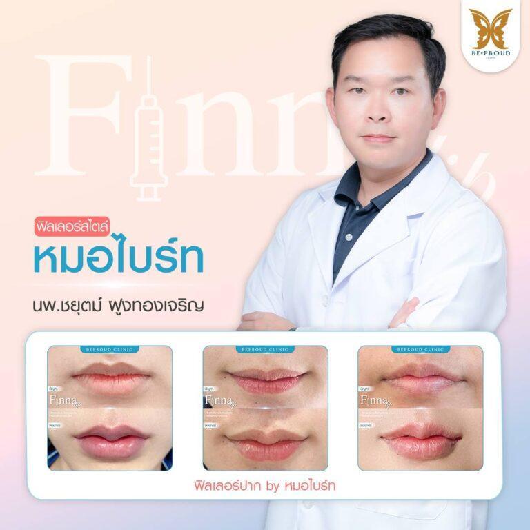 Filler Beproud Clinic