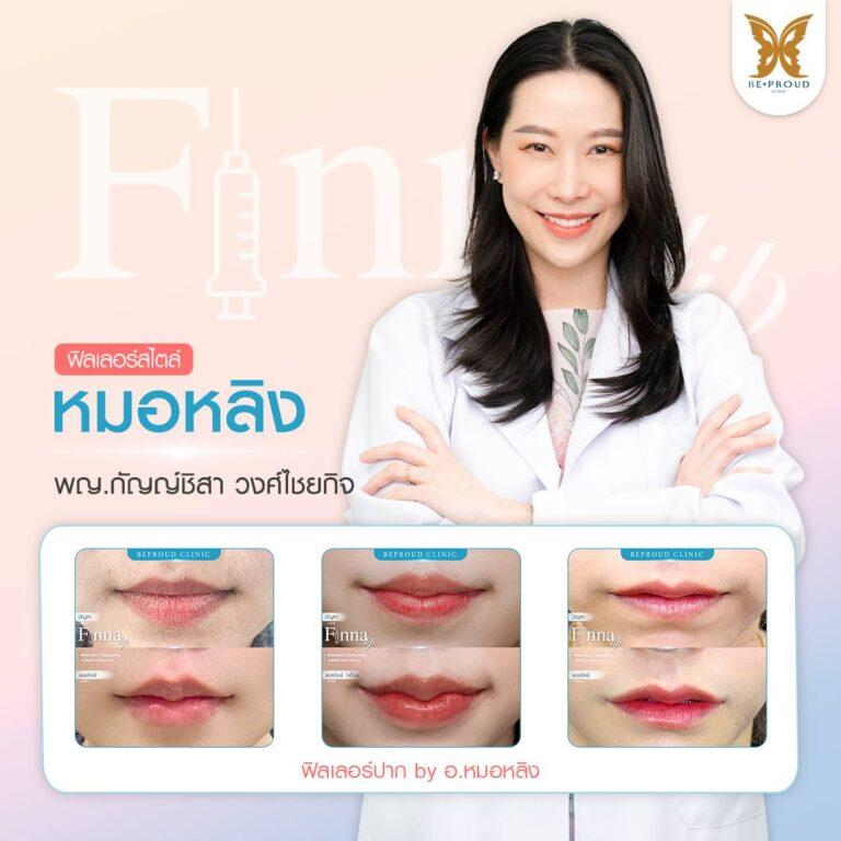 Filler Beproud Clinic