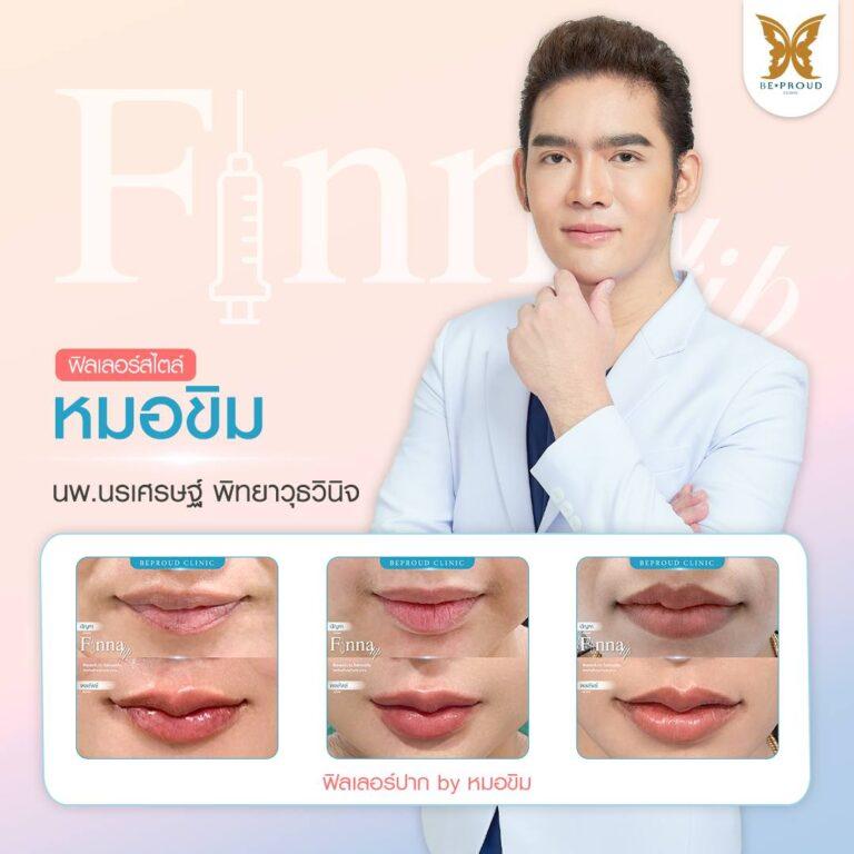 Filler Beproud Clinic