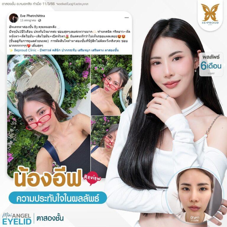 ตาสองชั้น บีพราวด์