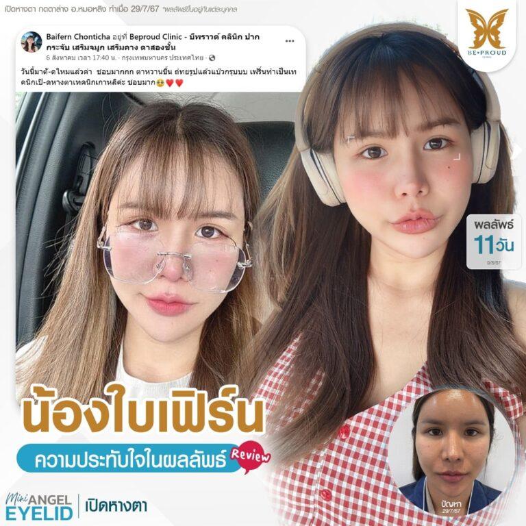 เปิดหางตา บีพราวด์