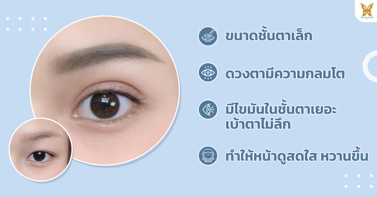 ตาสองชั้น สายเกาหลี