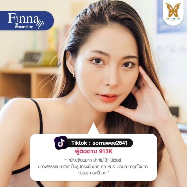 Filler Beproud Clinic