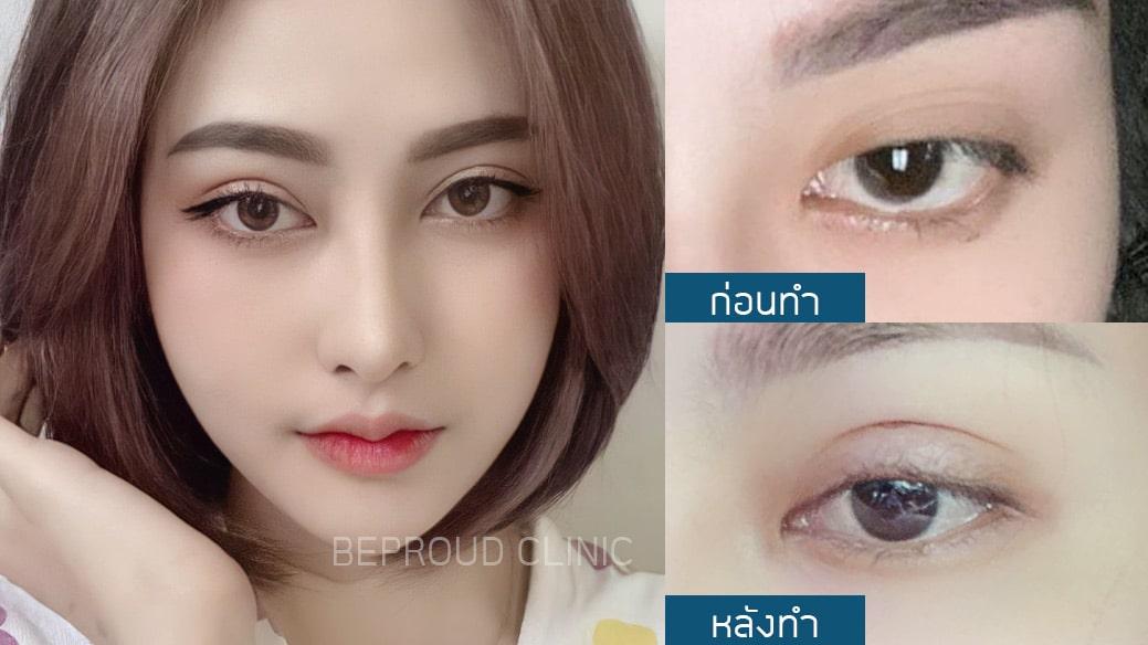 เผย "6 เทคนิคทำตาสองชั้น" ตาของเราเหมาะสมกับเทคนิคแบบไหน?