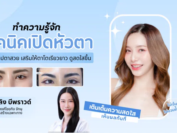 เปิดหัวตา, เปิดหัวตาคือ, เปิดหัวตาดีไหม, เปิดหัวตาเหมาะกับใคร, ข้อดีข้อเสียเปิดหัวตา, รีวิวเปิดหัวตา