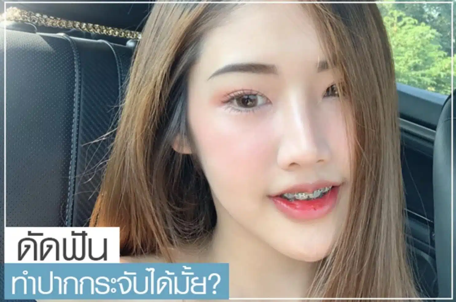 ดัดฟันทำปากกระจับได้มั้ย