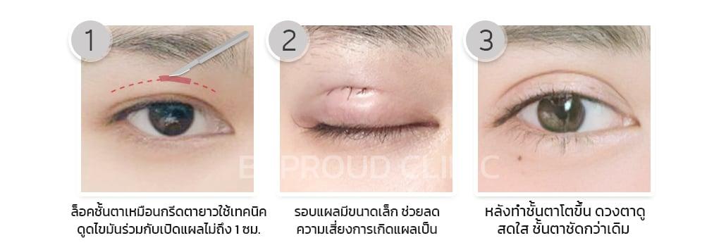 เผย "6 เทคนิคทำตาสองชั้น" ตาของเราเหมาะสมกับเทคนิคแบบไหน?