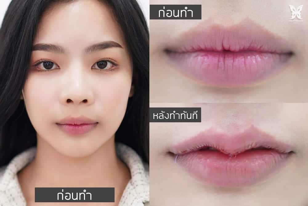 รีวิวปากกระจับปีกนางฟ้า บีพราวด์