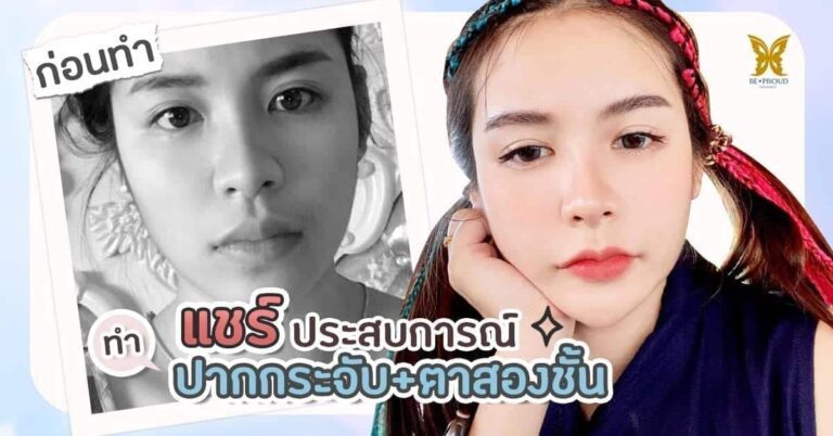 แชร์ประสบการณ์ ทำปากกระจับ ตาสองชั้น