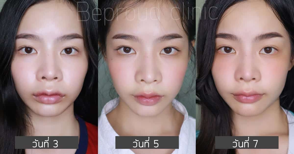 รีวิวปากกระจับปีกนางฟ้า บีพราวด์