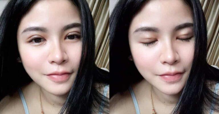 แชร์ประสบการณ์ ทำปากกระจับ ตาสองชั้น