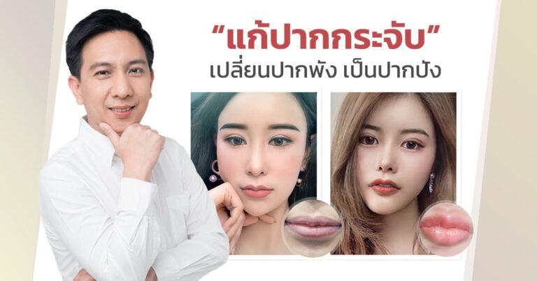 “แก้ปากกระจับ”เปลี่ยนปากพัง เป็นปากปัง!!