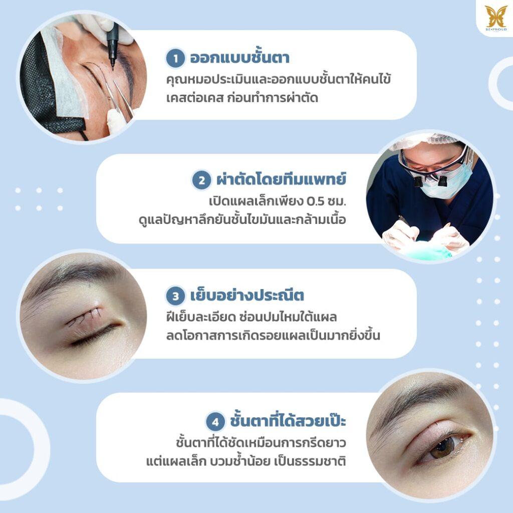ขั้นตอนการทำตาสองชั้น สายเกาหลี