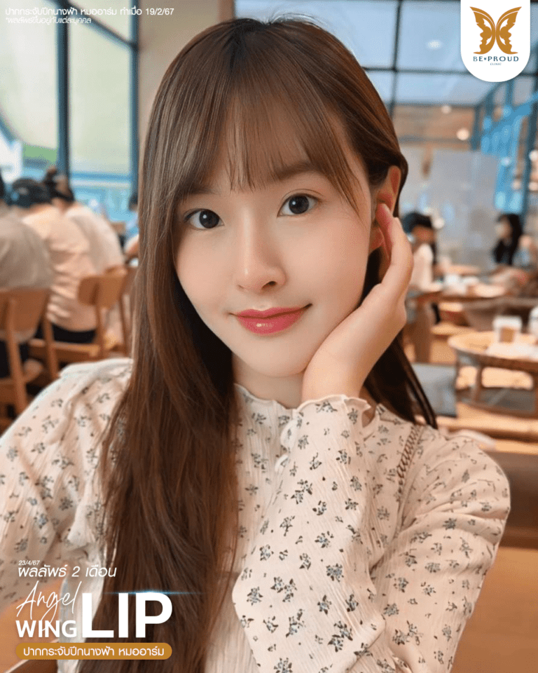 รีวิวตัดปากกระจับ แก้รูปปากไม่สมดุล