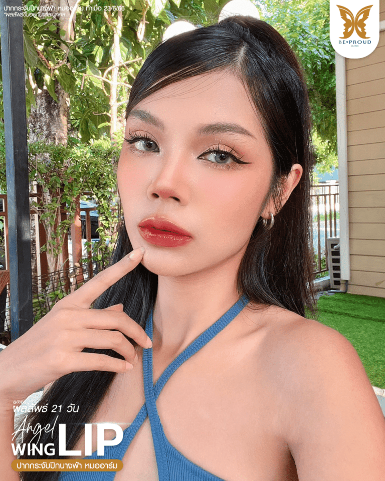 รีวิวตัดปากกระจับ แก้รูปปากไม่สมดุล