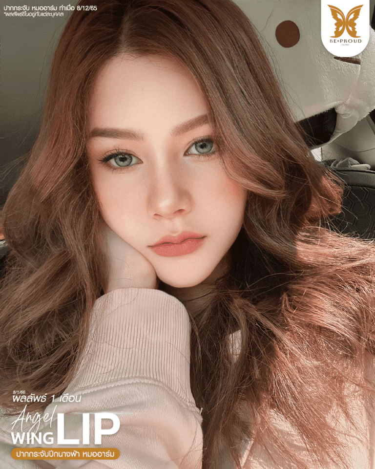 รีวิวตัดปากกระจับ แก้รูปปากไม่สมดุล