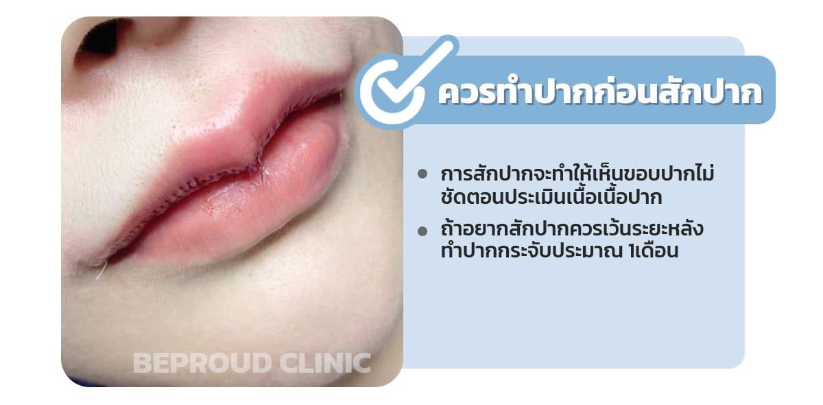 แนะนำให้ทำปากกระจับก่อนสักปาก