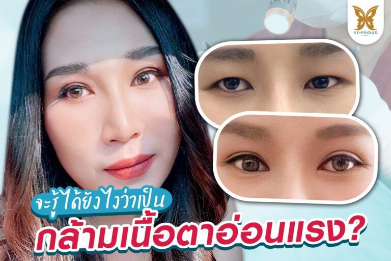 เป็นกล้ามเนื้อตาอ่อนแรง