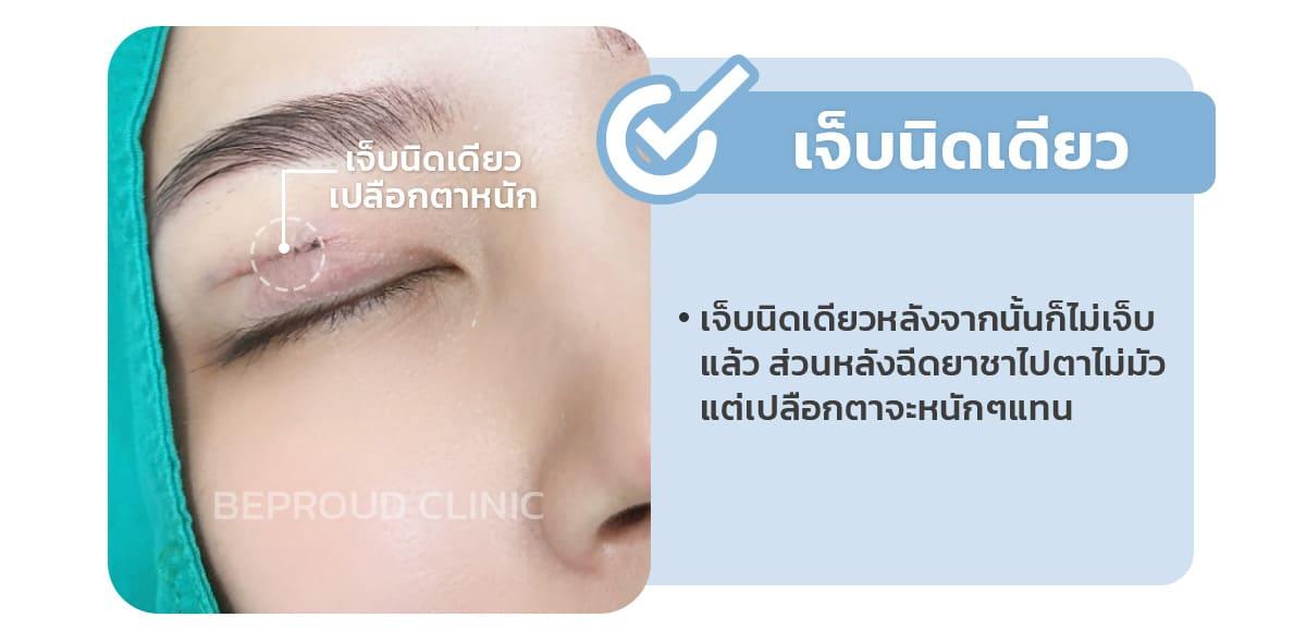 ตอนฉีดยาชาเจ็บมั้ย แล้วตาจะมัวมั้ยหลังฉีด