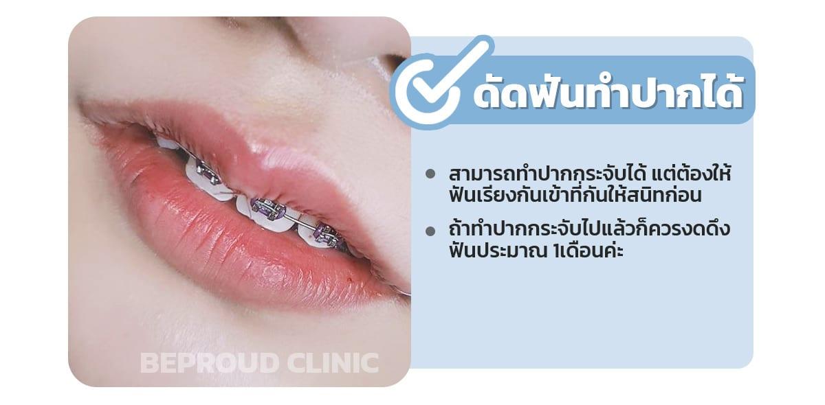 ดัดฟันทำปากได้
