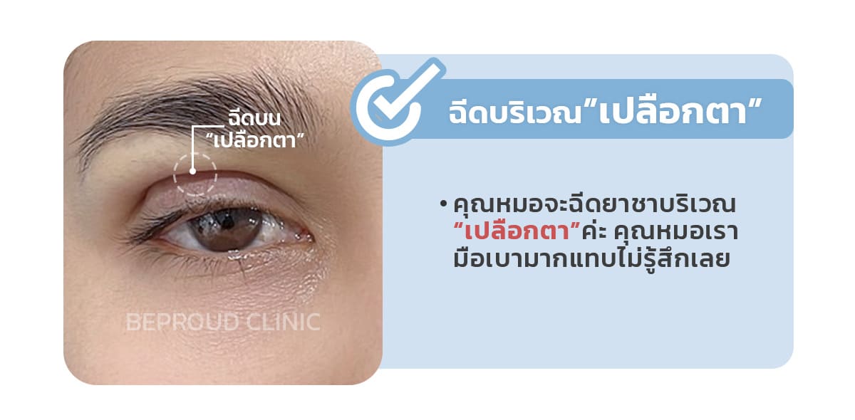 ตอนทำตาสองชั้นคุณหมอจะฉีดยาชาบริเวณไหน