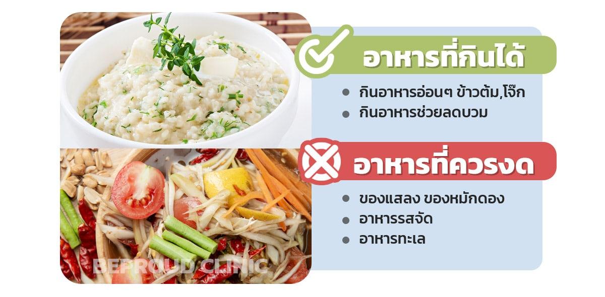 อาหารที่กิน และควรงดหลังทำปาก
