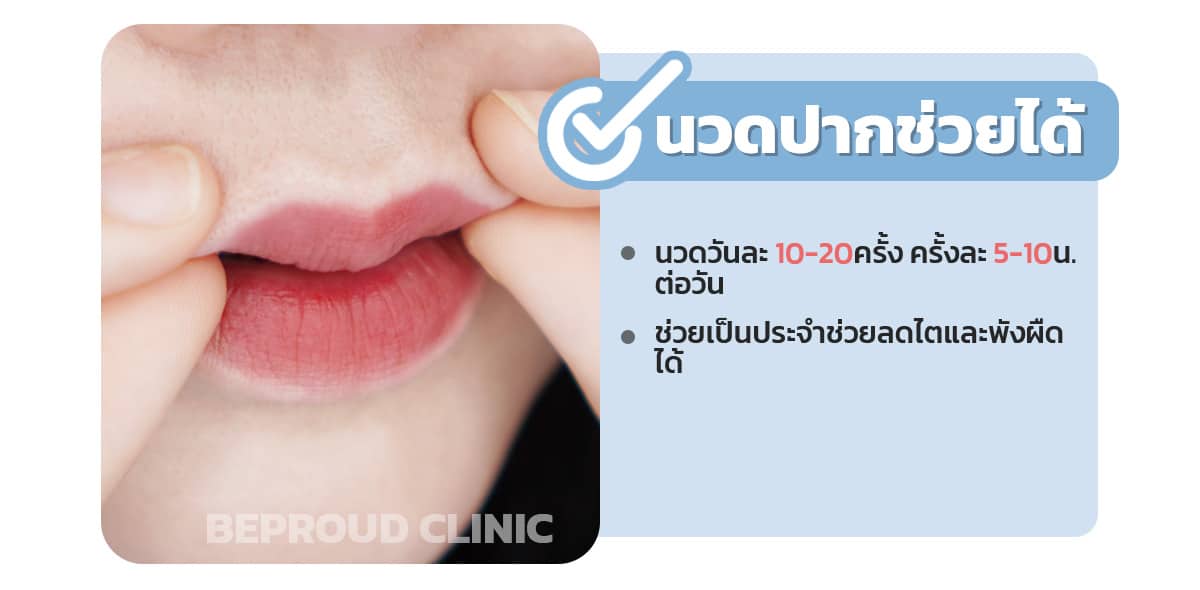 การนวดปากกระจับลดปากเป็นไต