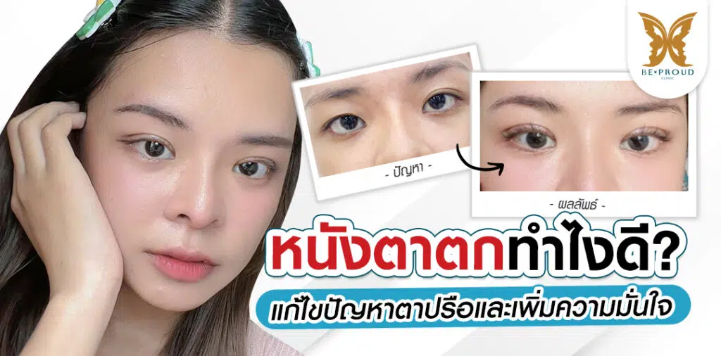 หนังตาตกทำไงดี? แก้ไขปัญหาตาปรือและเพิ่มความมั่นใจ