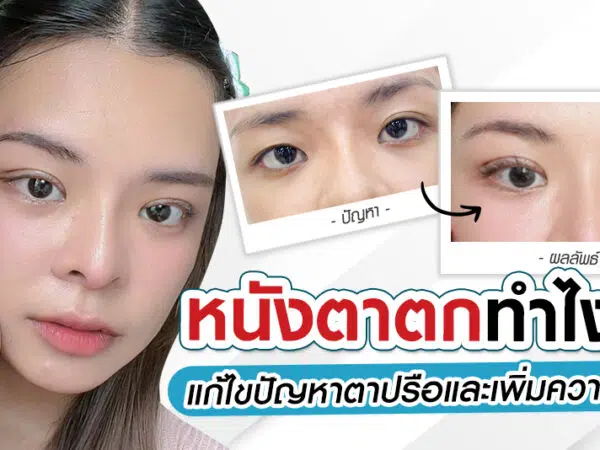 หนังตาตกทำไงดี? แก้ไขปัญหาตาปรือและเพิ่มความมั่นใจ