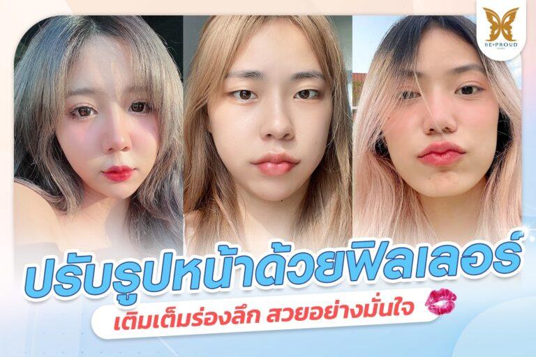 ฟิลเลอร์ปรับรูปหน้า เติมเต็มร่องลึก