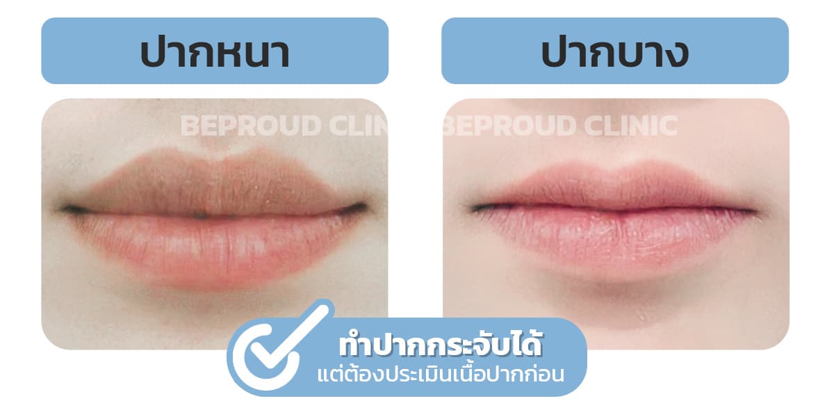 เนื้อปากหนา ปากบาง ทำปากกระจับ