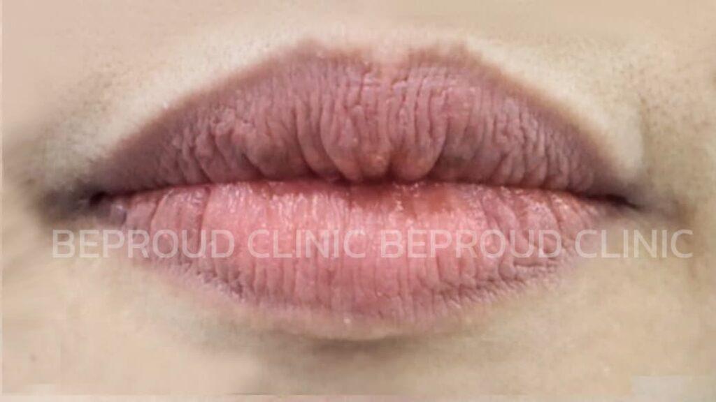 อายุที่เยอะมากขึ้น