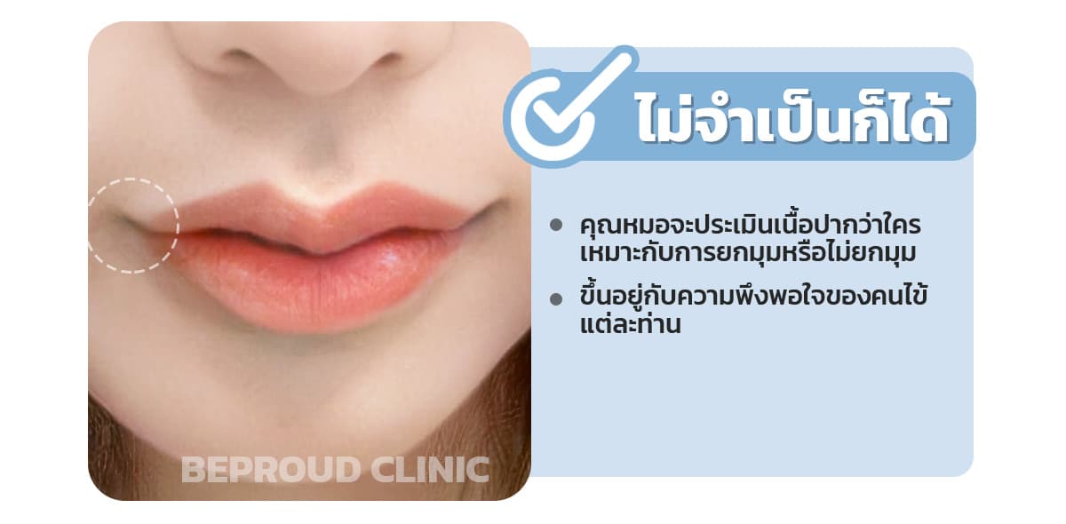ทำปากกระจับ ไม่จำเป็นต้องยกมุม