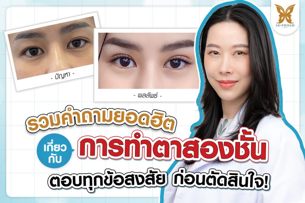 ตาสองชั้น ศัลยกรรมตาสองชั้น เทคนิคทำตาสองชั้น รีวิวทำตาสองชั้น